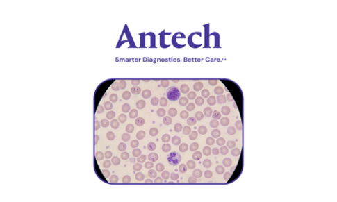 Antech – Vector-borne Disease: Babesia-testing and Treating
